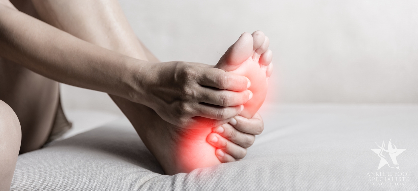 plantar fasciitis